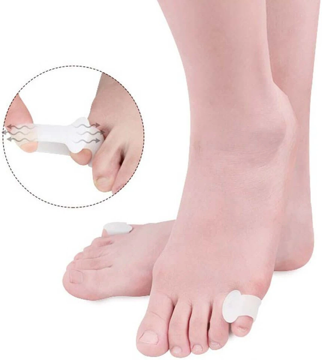 Solelution Kleine Teenspreider - Teencorrector - Per Paar 2 Solelution Kleine Teenspreider - Teencorrector - Per Paar - Afbeelding 2