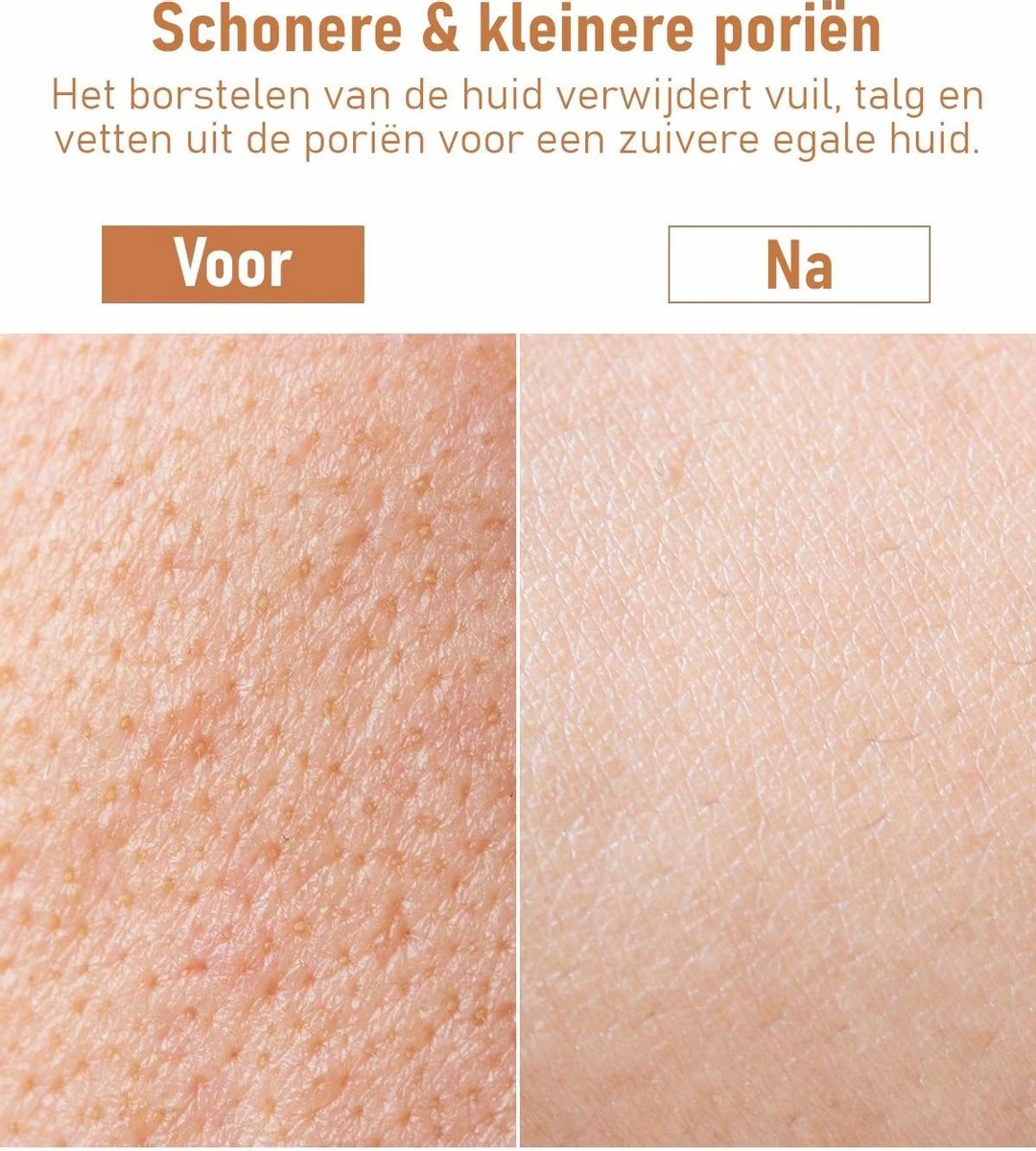 Fesio Lichaamsborstel Met Lange Steel - Dubbelzijdig - Dry Brushing Rugborstel/Badborstel/Doucheborstel/Huidborstel - 43 Cm 7 Fesio Lichaamsborstel Met Lange Steel - Dubbelzijdig - Dry Brushing Rugborstel/Badborstel/Doucheborstel/Huidborstel - 43 Cm - Afbeelding 7