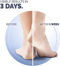 Scholl Klovenzalf - K+ Creme - Voor Hielkloven En Ruwe, Droge Huid -Verzorgings Producten Winkel 1094x1200