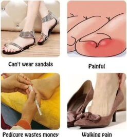 Merkloos Ingegroeide Teennagel Corrector -Verzorgings Producten Winkel 1111x1200