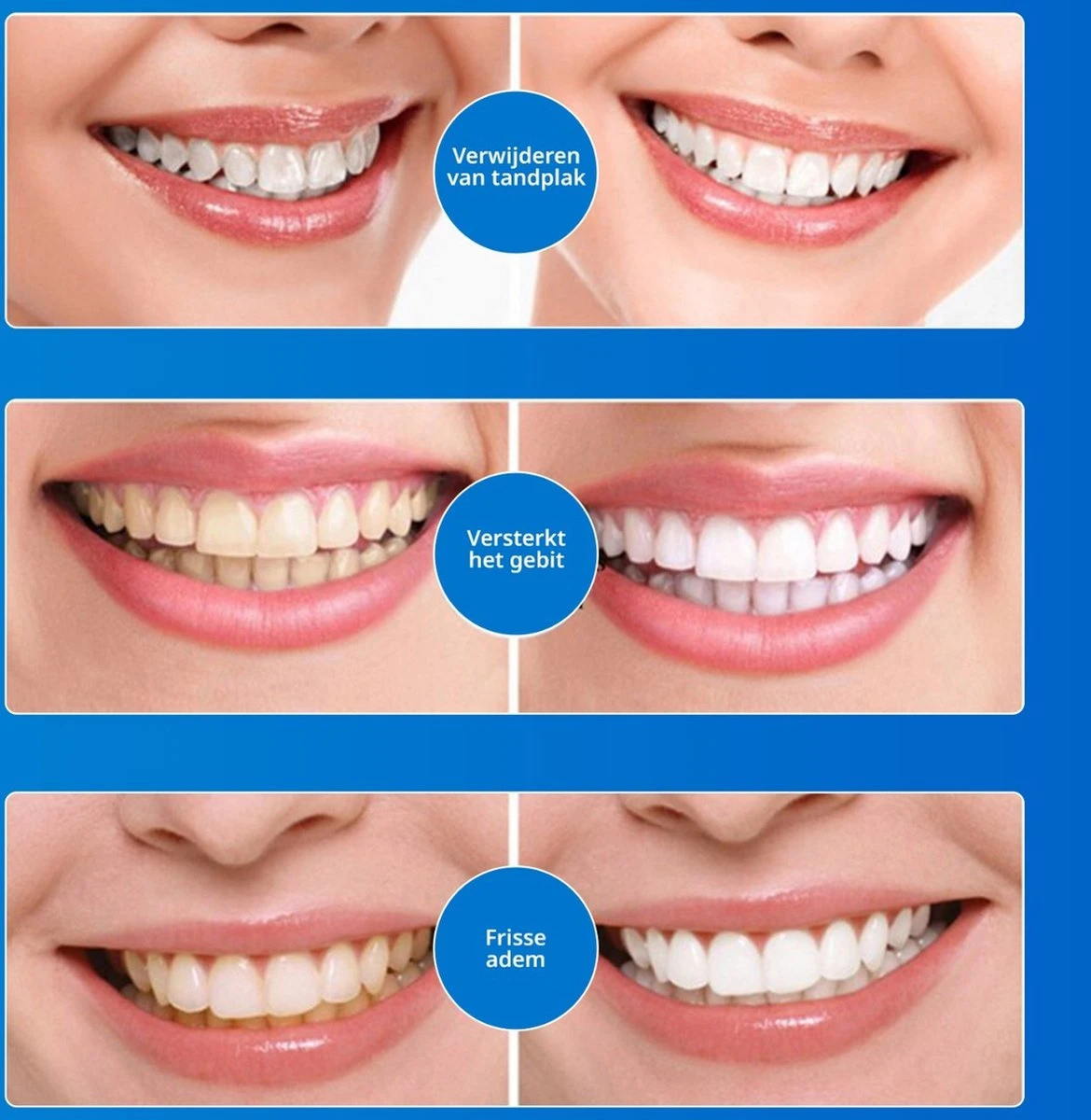 B-care Tanden Bleekpen - Teeth Whitening Pen - Tanden Bleker - Wittere Tanden - Teeth Whitening Strips - Professioneel Resultaat - Tandsteen Verwijderaar - Zonder Peroxide - Tandenbleekset - Tanden Bleken 8 B-care Tanden Bleekpen - Teeth Whitening Pen - Tanden Bleker - Wittere Tanden - Teeth Whitening Strips - Professioneel Resultaat - Tandsteen Verwijderaar - Zonder Peroxide - Tandenbleekset - Tanden Bleken - Afbeelding 8