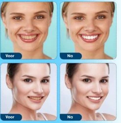 Diamond White - Teeth Whitening Strips - 28x Strips - Zonder Peroxide (0%) - Tandenbleekset - Tandenbleek Strips – Mint -Verzorgings Producten Winkel 1185x1200 7