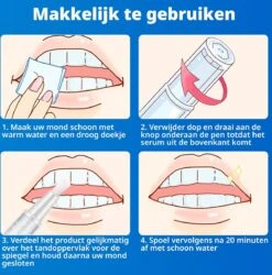 B-care Tanden Bleekpen - Teeth Whitening Pen - Tanden Bleker - Wittere Tanden - Teeth Whitening Strips - Professioneel Resultaat - Tandsteen Verwijderaar - Zonder Peroxide - Tandenbleekset - Tanden Bleken 14 B-care Tanden Bleekpen - Teeth Whitening Pen - Tanden Bleker - Wittere Tanden - Teeth Whitening Strips - Professioneel Resultaat - Tandsteen Verwijderaar - Zonder Peroxide - Tandenbleekset - Tanden Bleken -Verzorgings Producten Winkel 1185x1200 8