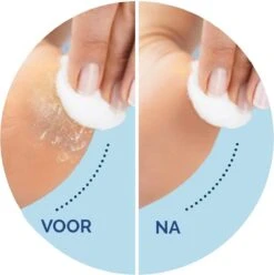 Scholl Velvet Smooth - Navulling Eeltverwijderaar - Extra Fijn - Voetvijl - 2 Stuks -Verzorgings Producten Winkel 1195x1200 2