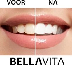 BELLAVITA Tandenbleekset - Tanden Bleken - Teeth Whitening Kit - Tandenblekers - 4 Gelpennen - Zonder Peroxide - 100% Natuurlijk - Witte Tanden -Verzorgings Producten Winkel 1200x1095 4