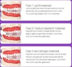 Edoir Rechte Tanden Beugel - Retainer Voor Rechte Tanden - Rechte Tanden Bitje -Verzorgings Producten Winkel 1200x1109 1