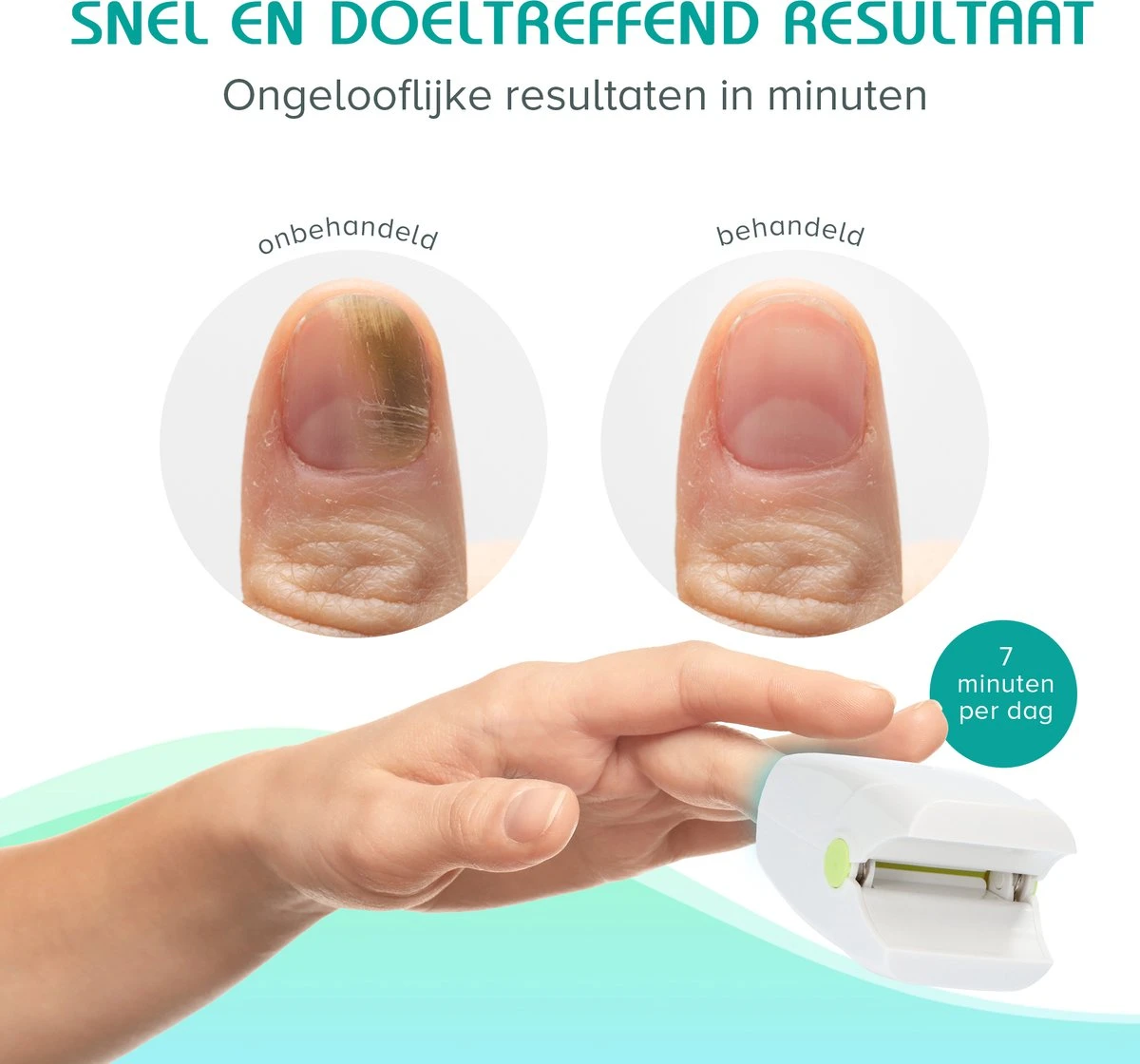 Anti Schimmelnagel Zelf-laserapparaat Incl. Pedicure Set 4 Anti Schimmelnagel Zelf-laserapparaat Incl. Pedicure Set - Afbeelding 4