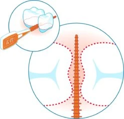 Tepe EasyPick Paars Maat XL – 36 Stuks -Verzorgings Producten Winkel 1200x1146 5