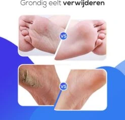 LifeWise Elektrische Eelt Verwijderaar - Voetvijl - 60 Vervangbare Schuurpads - Netstroom Adapter -Verzorgings Producten Winkel 1200x1155 1