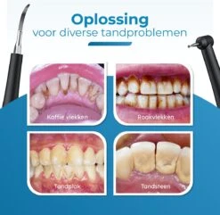 Professionele Tandsteen Verwijderaar - 5 Standen - Inclusief Tandarts Set - Met 3 Opzetstukken - Elektrisch - Tandplak -Verzorgings Producten Winkel 1200x1169 6
