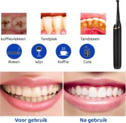 ExCorn Elektrische Tandsteen Verwijderaar - Inclusief 6-delig Tandartsset - 3 Standen - Elektrisch Tandplak Verwijderen - Tanden Polijsten 13 ExCorn Elektrische Tandsteen Verwijderaar - Inclusief 6-delig Tandartsset - 3 Standen - Elektrisch Tandplak Verwijderen - Tanden Polijsten -Verzorgings Producten Winkel 1200x1173 7