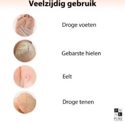 PureLuxure Voetmasker - Voetverzorging - Eeltsokken - Eelt Verwijderaar - Voetenmasker - Peel Off Masker - 1 Paar (2 Stuks) -Verzorgings Producten Winkel 1200x1174