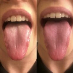 Orabrush Tongreiniger -Verzorgings Producten Winkel 1200x1197 19