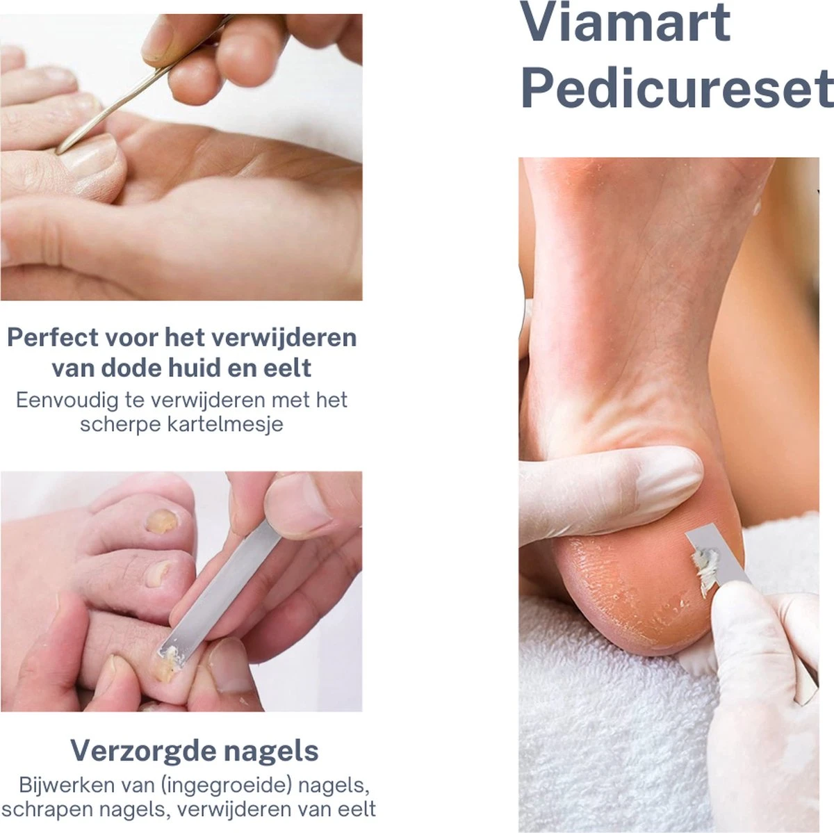 Viamart - Teen En Nagel Pedicure - Mes - Nagels Bijwerken - Voeten Schraper - (3 Stuks) 2 Viamart - Teen En Nagel Pedicure - Mes - Nagels Bijwerken - Voeten Schraper - (3 Stuks) - Afbeelding 2