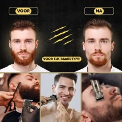 6-in-1 Baardtrimmer Mannen - Trimmer Voor Baard En Lichaam - Incl. 6 Opzetstukken - Bodygroomer Mannen - Bodytrimmer Heren - Tondeuse - 0.5-15MM - Neus En Oor -Verzorgings Producten Winkel 1200x1199 13