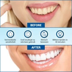 V-Goods Premium Whitening Strips - Tandenbleek Strips - Wittere Tanden - 28x Tandenbleek Strips DIRECT Resultaat - Tandenbleekset - Whitening - Tandenblekers -Verzorgings Producten Winkel 1200x1199 30