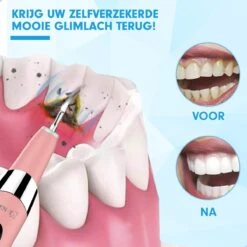 DEN-T® PRO U500 - Elektrische Sonische Tandsteen Verwijderaar - Roze 18 DEN-T® PRO U500 - Elektrische Sonische Tandsteen Verwijderaar - Roze -Verzorgings Producten Winkel 1200x1200 1546