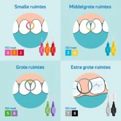 TePe Interdentale Ragers Original Geel ISO Maat 2 – 0,7 Mm (20 Stuks) -Verzorgings Producten Winkel 1200x1200 1559