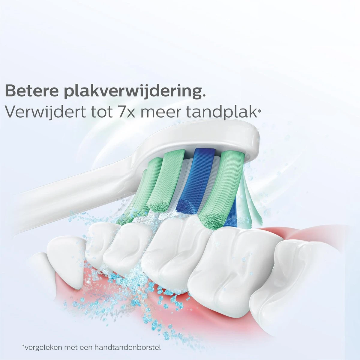 Philips Sonicare C2 Optimal Plaque Defence HX9024/10 - Opzetborstels - 4 Stuks 11 Philips Sonicare C2 Optimal Plaque Defence HX9024/10 - Opzetborstels - 4 Stuks - Afbeelding 11