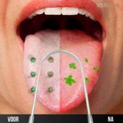 SolidStock Professionele Tongschraper Voor Mondverzorging - 4 Delige Tongreiniger - Ayurveda - RVS -Verzorgings Producten Winkel 1200x1200 1828