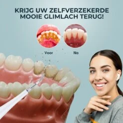 Merkloos Tandsteen Verwijderaar Elektrisch – Tandenborstel Opzetstukken - Tandarts Spiegel - 5 Standen -Wit 14 Merkloos Tandsteen Verwijderaar Elektrisch – Tandenborstel Opzetstukken - Tandarts Spiegel - 5 Standen -Wit -Verzorgings Producten Winkel 1200x1200 1890