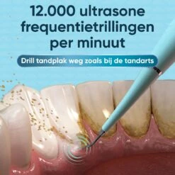 Whitee Elektrische Tandsteen Verwijderaar - Tanden Polijsten - Tandarts Tandsteenverwijderaars - Elektrisch Tandplak Verwijderen -Verzorgings Producten Winkel 1200x1200 1909