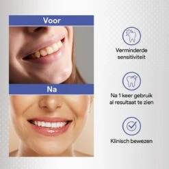 Merkloos Tanden Bleken Met 14 Sets Whitening Strips - Tandenbleekset Met Bamboe Tandenborstel - Tanden Bleekstrips -Verzorgings Producten Winkel 1200x1200 1931