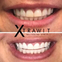Xtrawit - Teeth Whitening Strips - Tandenbleekset - Wittere Tanden - Goedgekeurde Tandenbleek Strips - 30 Strips -Verzorgings Producten Winkel 1200x1200 1941