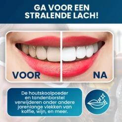 Tandenbleekset - Teeth Whitening - Teeth Whitener - Wittere Tanden - Tanden Bleken - Direct Resultaat - Zelfde Effect Als Whitening Strips -Verzorgings Producten Winkel 1200x1200 1945