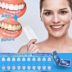 Merkloos Professionele Tanden Bleek Strips Ultra 3D - Teeth Whitening Strips - Tanden Bleken - Voor Ultra Witte Tanden - 14 Strips -Verzorgings Producten Winkel 1200x1200 1968