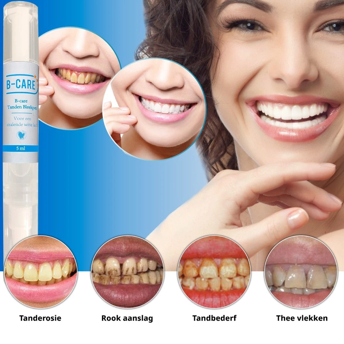 B-care Tanden Bleekpen - Teeth Whitening Pen - Tanden Bleker - Wittere Tanden - Teeth Whitening Strips - Professioneel Resultaat - Tandsteen Verwijderaar - Zonder Peroxide - Tandenbleekset - Tanden Bleken 7 B-care Tanden Bleekpen - Teeth Whitening Pen - Tanden Bleker - Wittere Tanden - Teeth Whitening Strips - Professioneel Resultaat - Tandsteen Verwijderaar - Zonder Peroxide - Tandenbleekset - Tanden Bleken - Afbeelding 7