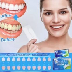 Merkloos Tanden Bleken - Witte Tanden - 5D White Teeth Whitening Strips - Teeth Whitening Strips - 28x Tandenbleek Strips - Zonder Peroxide (0%) -Verzorgings Producten Winkel 1200x1200 2019