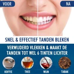 Southland Tandenbleekset - Tandenblekers - Whitening Strips - Teeth Whitening - Tanden Bleken -Verzorgings Producten Winkel 1200x1200 2020