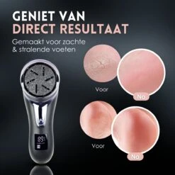 Beeperfect® Elektrische Eeltverwijderaar Met Stofzuigsysteem - Voetvijl - Eeltvijl - IPX7 Waterdicht - Gratis Pedicure Set - Zwart -Verzorgings Producten Winkel 1200x1200 223