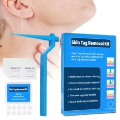 Steelwratjes Verwijderaar - Steelwratjes Verwijderen - Pijnloos En Snel - Wrattenverwijderaar - Steelwratten