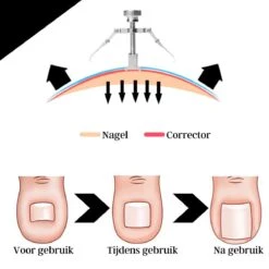 7-delige Pedicure En Manicure Set - Nagelknipper - Pedicureset - Nagelvijl - Nageltang - Kalknagel - Teennagelknipper -Verzorgings Producten Winkel 1200x1200 372