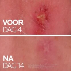 La Roche-Posay Cicaplast Balsem B5+ - 40ml - Voor Gevoelige Huid - Helpt De Huid Herstellen -Verzorgings Producten Winkel 1200x1200 574