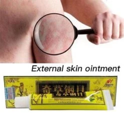 Psoriasis/exzeem Chineese Creme -Verzorgings Producten Winkel 1200x1200 590