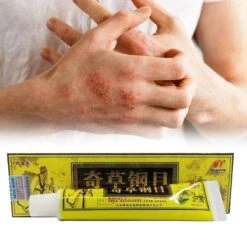 Psoriasis/exzeem Chineese Creme -Verzorgings Producten Winkel 1200x1200 591