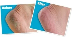 O'Keeffe's - Voetencreme - Voor Gezonde Voeten - Potje 96 Gram 16 O'Keeffe's - Voetencreme - Voor Gezonde Voeten - Potje 96 Gram -Verzorgings Producten Winkel 1200x622