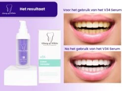 Glory Of White V34 Serum - Kleurcorrector - Witte Tanden - Tandpasta - Tanden Reinigen - Teeth Whitening - 30ML -Verzorgings Producten Winkel 1200x899 13