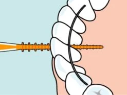 Tepe EasyPick Oranje Maat XS/S – 36 Stuks -Verzorgings Producten Winkel 1200x902 4