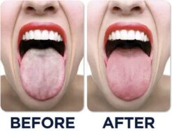 JuliBrite Tong Gel (50 ML) Tongreinigende Gel - Verfrist De Adem - Schone Tong -Verzorgings Producten Winkel 1200x914 2