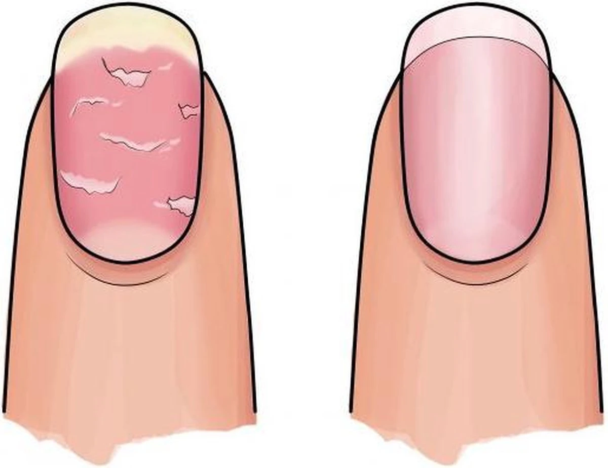 Herome 3 In 1 Manicure Nagelverzorging Set – Beschadigde Nagels – Nagelriemolie, Nagelriemcrème En Nagelverharder 4 Herome 3 In 1 Manicure Nagelverzorging Set – Beschadigde Nagels – Nagelriemolie, Nagelriemcrème En Nagelverharder - Afbeelding 4