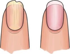 Herome 3 In 1 Manicure Nagelverzorging Set (Nail Essentials Geel) – Nagelset Voor Droge En Geribbelde Nagels – Base Coat, Vijl En Voedende Nagelolie – Voor Egale En Flexibele Nagels -Verzorgings Producten Winkel 1200x926