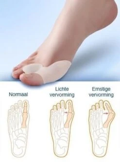 MYCARE+ Teencorrector - Wasbare Teencorrector - Gel-laag - 1 Paar - Pijn Verlichtend -Verzorgings Producten Winkel 890x1200 3