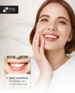 Tandenbleekset INCL. 14 Whitening Strips En 6 Gelpennen - ZONDER PEROXIDE - Teeth Whitening Kit - Tandenbleekset Met Ebook En Nederlandse Handleiding - Tandenblekers - Valentijnsdag Cadeau -Verzorgings Producten Winkel 960x1200 47