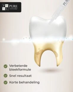3x Navulling Tanden Bleekgel Spuiten ZONDER Peroxide - Refill Gel - Navulling - Veilig Tanden Bleken - Witte Tanden - Teeth Whitening - Valentijnsdag Cadeau -Verzorgings Producten Winkel 960x1200 57